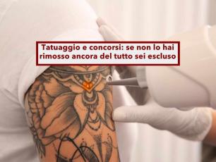 Concorso Polizia, sei escluso se hai un tatuaggio visibile, anche se lo stai togliendo con il laser: nuova sentenza