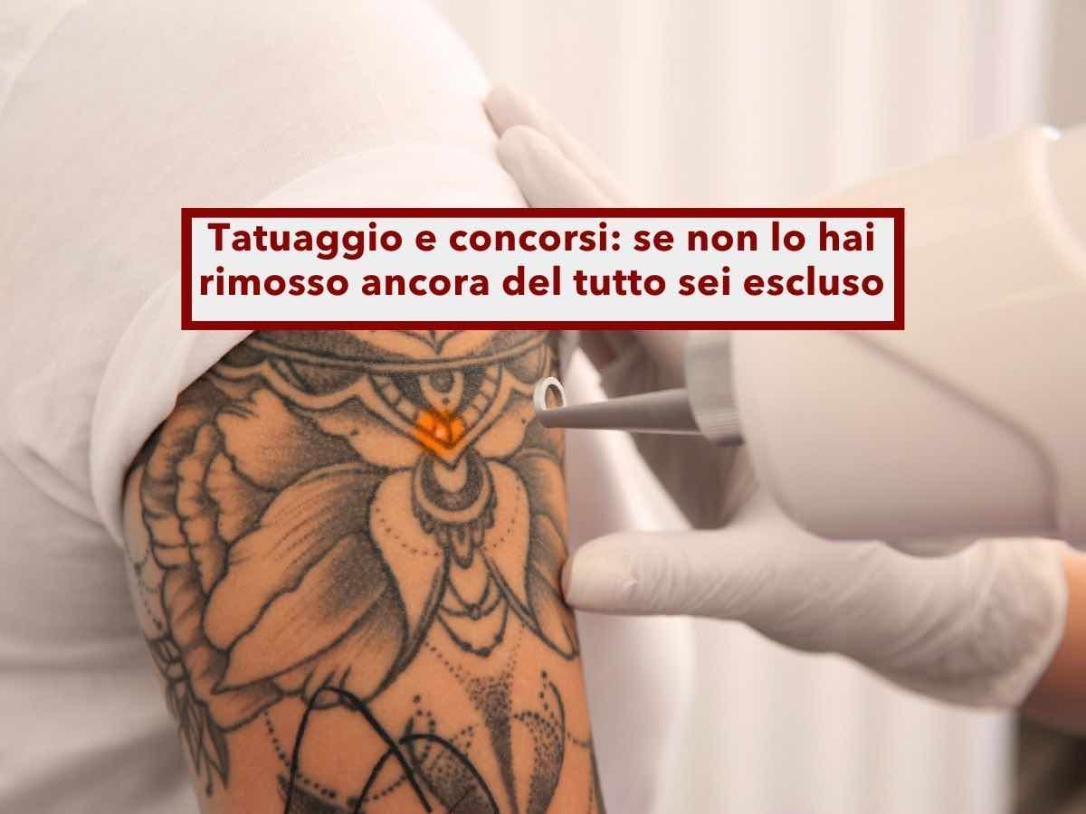 Concorso Polizia, sei escluso se hai un tatuaggio visibile, anche se lo stai togliendo con il laser: nuova sentenza