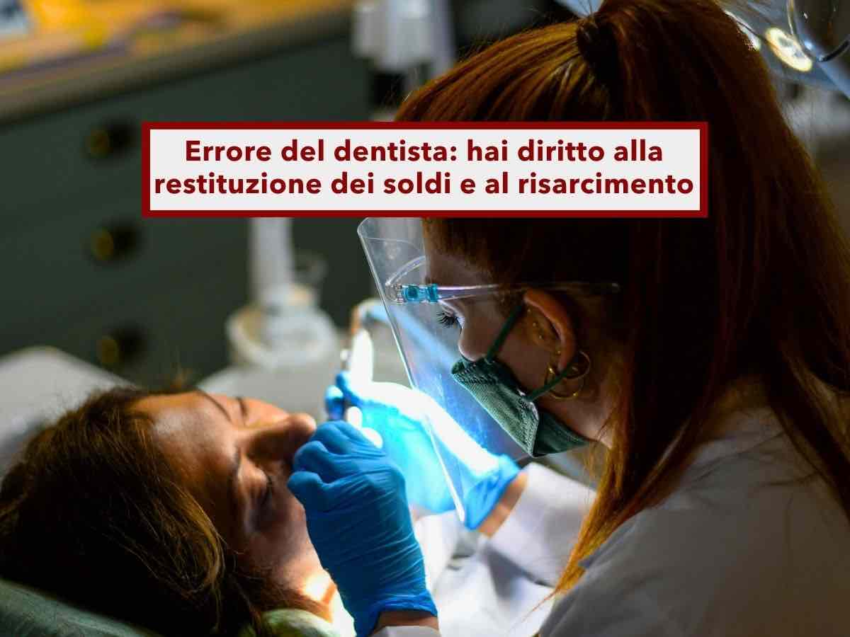 Errore del dentista, puoi farti restituire i soldi e ottenere un risarcimento se sei stato curato male: ecco la sentenza