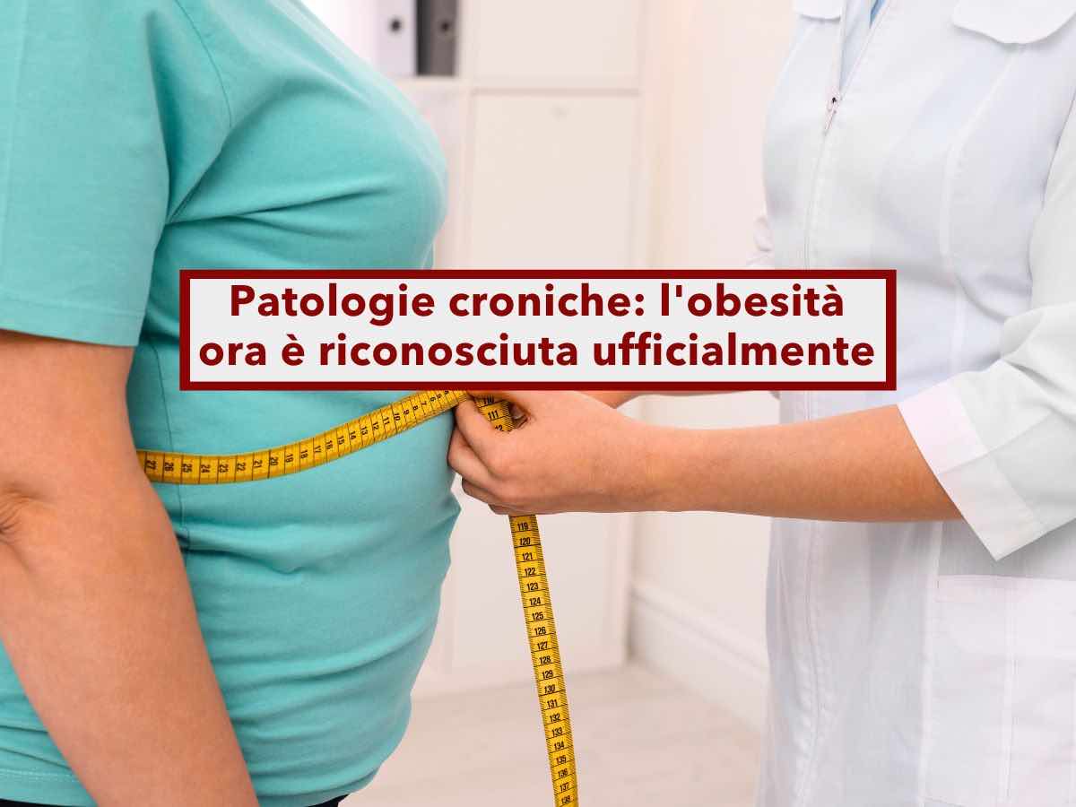 Patologie croniche, da oggi anche l'obesit  una malattia: ecco tutte le novit e i vantaggi per chi ne  affetto